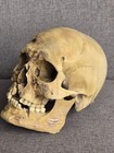 Human Skull Replica  With Battle Wound