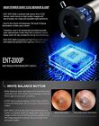 Endoscopy Camera With Hd Portable Usb For Medical Ent Rigid Endoscope Windows 