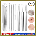 Acne Needle Blackhead Remover Pimple Blemish Comedone Extractor Tweezer Tool Kit