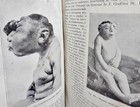 1917 Autopsy Book Crime Victims Antique Medical Freaks  Post Mortem  0 Tariffs
