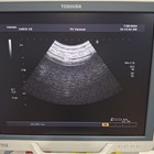 Toshiba Xario Xg Ssa-680a Ultrasound