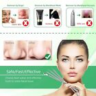 5pcs Blackhead Remover Comedone Extractor Curved Tweezers Kit Pimple Acne Tools 