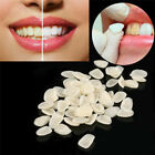 96pc Tooth Veneer 23 Dental Veneers Porcelain Anterior Resin Thin Teeth A1 A2 A3