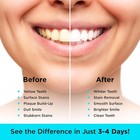 Carbon White Teeth Whitening Powder - Natural Activated Coconut Charcoal Tooth P
