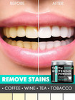 Teeth Whitening Powder - Remineralizing Tooth Powder For Tooth Whitening 5 In 1 