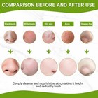 Blackhead Remover Mask  Charcoal Peel Off Face Mask   Charcoal Face Mask For    