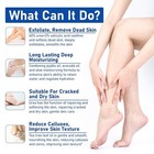 Urea Cream 60  For Feet Maximum Strength  Foot Lotion With 2  Salicylic    