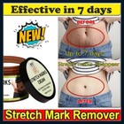Best Scar Removal-cream For Old-scars Stretch Mark Removal Cream For Men   Women