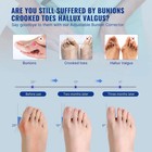 Bunion Corrector For Women   Men Big Toe Straightener Bunion Splints Correction