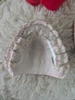 Orthodontic Retainer   Hawley Retainer