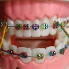 16 Color Dental Orthodontic Elastic Rubber Ligature Tie power Chain Double Color