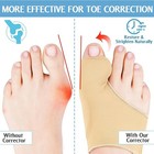2pcs Big Toe Bunion Corrector Splint Straightener Foot Pain Relief Hallux Valgus