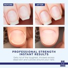 Cuticle Remover Cream For Dry Damaged Cuticles  Moisturizing Cuticle Softener Fo