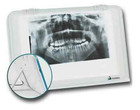 Dental X Ray Film Viewer Led Illuminator Wall Desk Mounting View Box Luna Xray