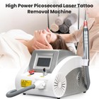 Q Switch Nd Yag Laser Machine For Tattoo Removal Skin Whitening   Rejuvenation