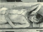 Antique Medical Post Mortem Photo 5996 Oddleys Strange   Bizarre