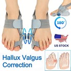 1 Pair 180   Bunion Corrector Silicone Toe Separator Straightener Orthopedic Toes