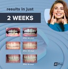 A-pro Night Teeth Aligner     Private Mouth Piece For Teeth Gaps  Crooked Teeth