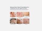 100  Silicone Scar Gel Scar Cream - Advanced Scar Gel For Surgical Scars  C-s   
