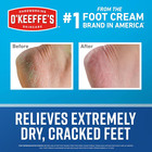 Foot Cream 3 2 Oz Jar Moisturizing Lotion For Dry Rough Feet 1 Pack