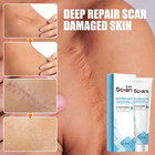 Scar Removal Cream Keloid   Stretch Mark Remover Scar Care For Burns Skin