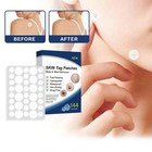 720pcs Skin Tag Remover Patches Quick Effective Mole Wart Removal Pad Sticker