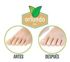 Oriundo Natural Life   Nail Fungus Away  quita Hongos Para U  as  0 5 Oz  New Usa