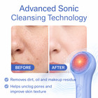 Electric Silicone Facial Cleansing Brush Sonic Face Scrubber Heated Ipx7 Blue