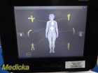 2021 Halcyon Sr Ultrasound System W  Linear Probe   Rolling Stand   36448