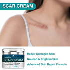 Scar Mark Reducer For Men   Women Acne   Stretch Mark New Old Scars Repair Cream