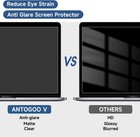Screen Protector For Macbook Pro 15 Inch - Eye Protection Anti Glare Film