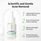 Lanbena 10  Salicylic Acid Serum  Acne Repair  Dead Skin Peels   Exp 8 2026