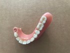 Vintage Dentures False Teeth Dental Plate Lower Partial Oddities Weird  4