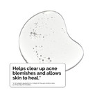 The Ordinary Salicylic Acid 2  Exfoliating Blemish Solution 1oz Anti-acne Serum