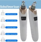 Pimple Popper Electric Blackhead Remover Dermabrasion Pore Vacuum