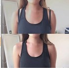 4-8pcs Bra Strap Clips Elastic Non-slip Strap Holder Women Bra Rope Adjustable