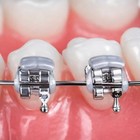 J j    Orthodontic Bracket Guard Elastic Bumper  10x12per Bag 