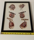 Antique Medical Dental Examples Of Tooth Key Extraction  Framed Print