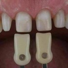 Ivoclar Vivadent Dental Shade Guide A-d 20 Ips Natural Die Nd1-9 Bleach Teeth