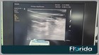 Philips L12-4 Linear Array Ultrasound Transducer Probe For Cx30   Spark Tested  