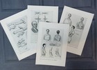 Set Antique 1912 Medical Bandages Slings Injured Patients Book Print Pictures