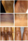 Dark Skin Bleaching Cream Whitening Lightening Aha - Face   Body  15g  
