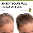 Focus Hair Fibers - 60 Grams  Instant Cover Bald   Thinning Spots In 30 Seconds 