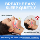 Vitalsleep Anti-snoring Device Women s Clear Snore Stopper Mouth Guard Official