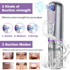 2025 Blackhead Remover Pore Vacuum facial Pore Cleaner Powerful Suction 5 Probes