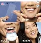 Crest 3d Professional White With Light  Teeth Whitening Kit - 19 Treatments