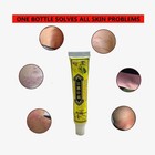Cream Psoriasis Eczema Treatment Dermatitis Skin For Body Relief Natural 