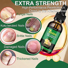 Nail Fungus Treatment Serum Repair Damaged Dry Nails Vitamin Cuticle Care