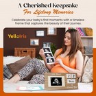 Brown Ultrasound Sonogram Picture Frame With Milestone Tracker     Elegant Wood   