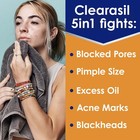 Clearasil Stubborn Acne Control 5in1 6 76 Fl Oz  pack Of 2   White